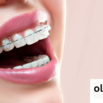 Brasssmile