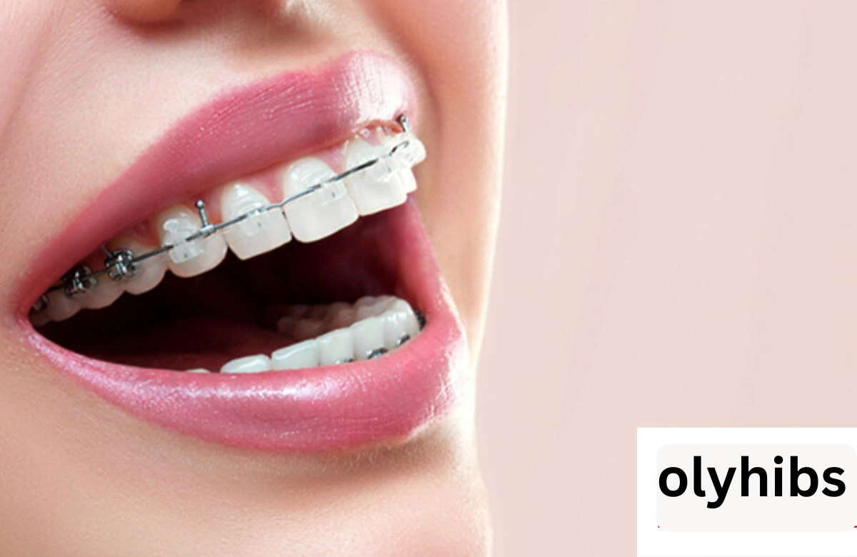 Brasssmile